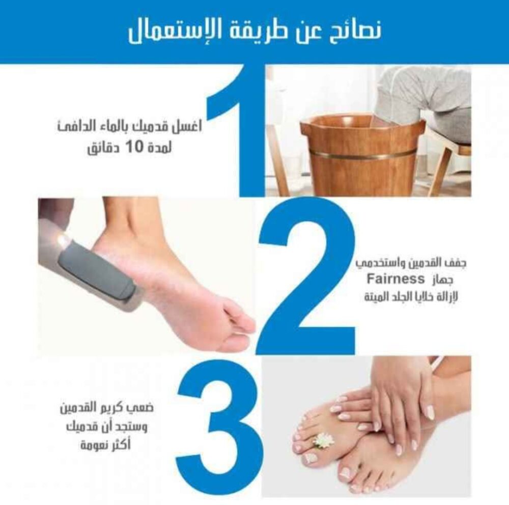 ⁦آلة تقشير القدمين الأصلية شحن USB⁩ - الصورة ⁦3⁩