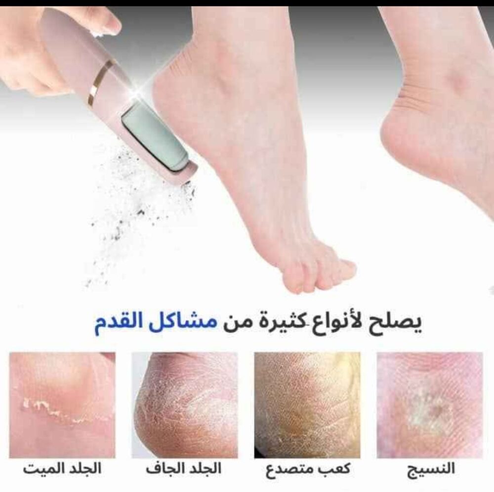 ⁦آلة تقشير القدمين الأصلية شحن USB⁩ - الصورة ⁦7⁩