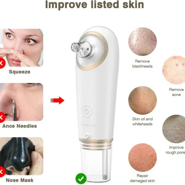 جهاز إزالة الرؤوس السوداء من KinseiBeauty